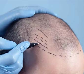 anti aging treatment clinic in near tambaram